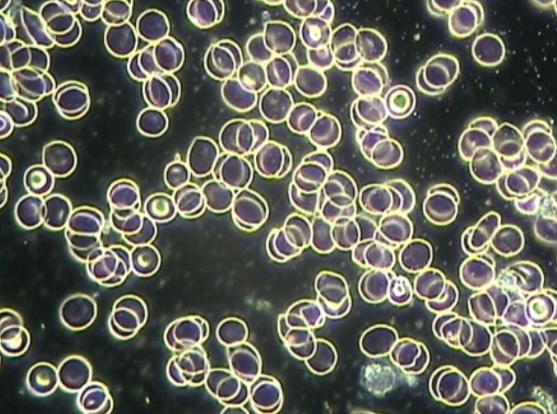 Correct-Baseline Blood